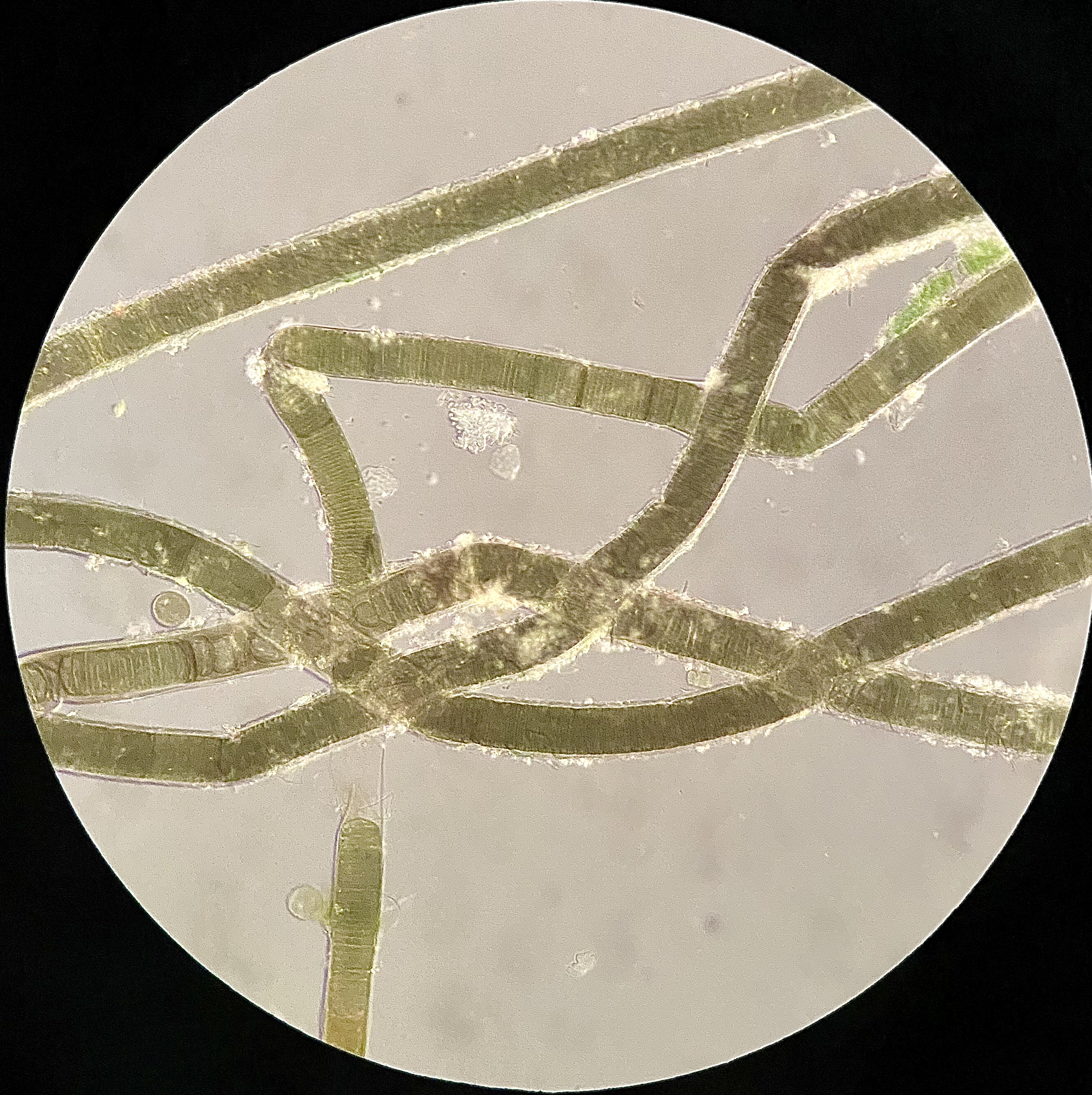 Microseira wollei under a microscope.