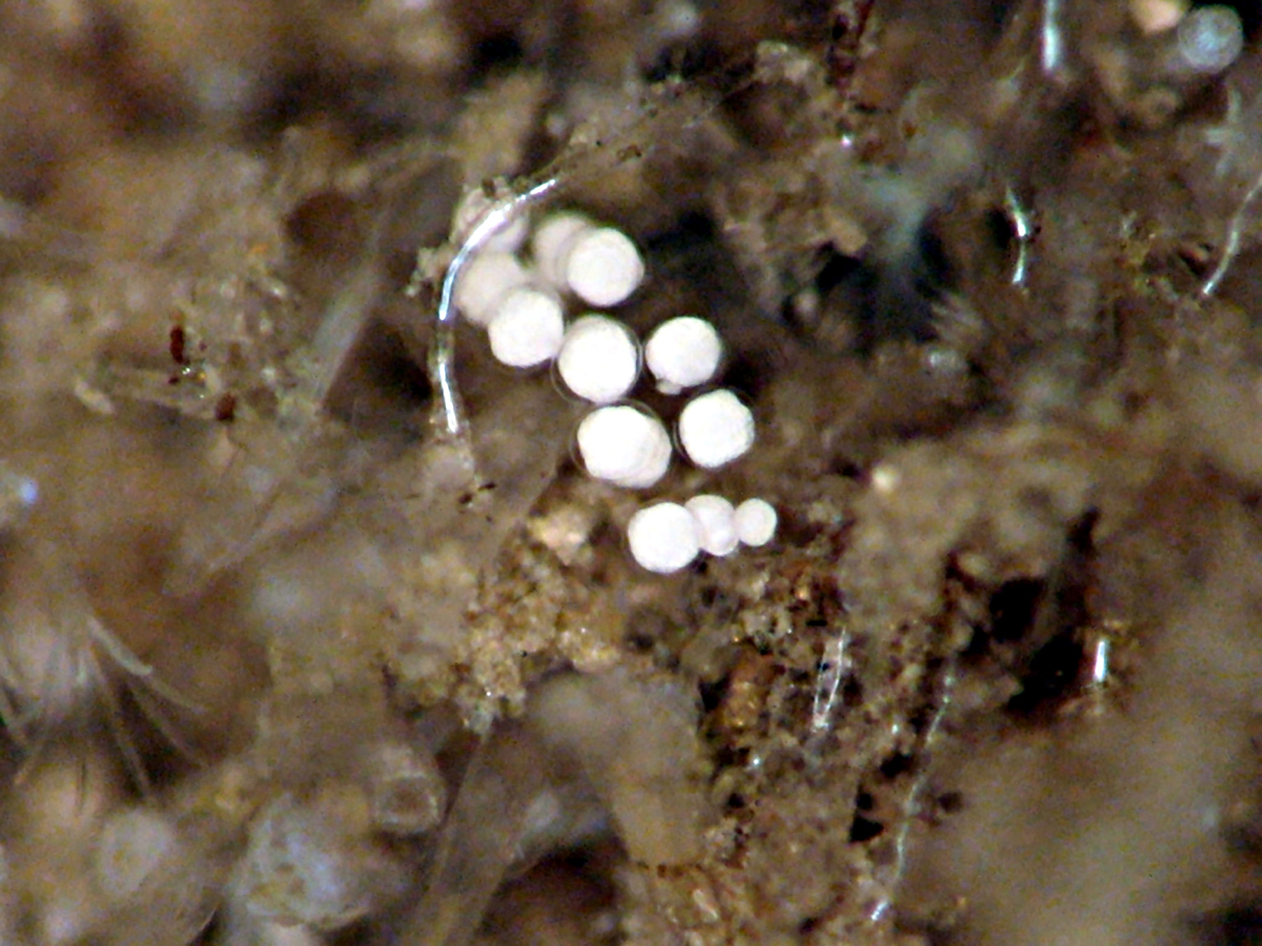 A clear gel with 11 visible white spheres