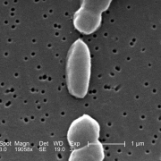 This scanning electron micrograph (SEM) depicts a number of <I>Vibrio parahaemolyticus</I> bacteria; Mag. 19058x. Photo courtesy of CDC/Janice Carr