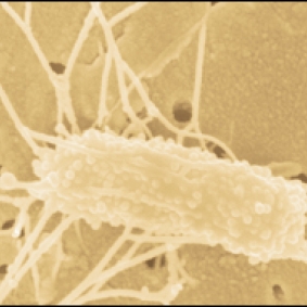 Bay Microbe Makes Big