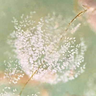 close up of a Colonial Ciliate, that looks like a fuzzy ball, similar in shape of a dandelion